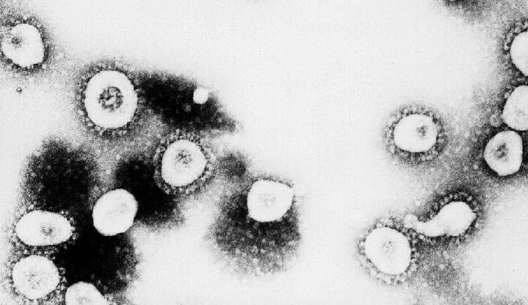 This photo shows a microscopic view of a coronavirus. 